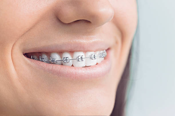 Best Veneers and Lumineers  in Dover, DE